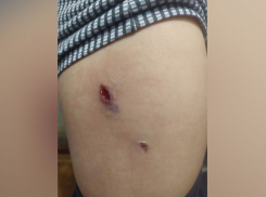 В Саратове на детской площадке поселилась стая собак. Есть пострадавшие 