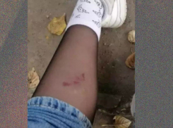 Очередное нападение бродячих собак в Саратове: фейк или правда?